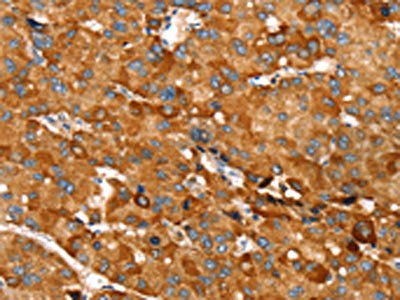 Anti-RNF14 Antibody