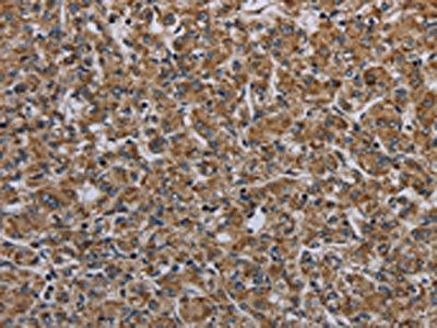 Anti-MYO7A Antibody