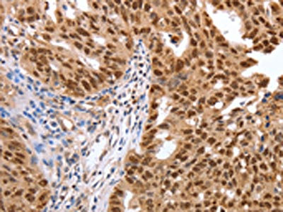 Anti-PARP1 Antibody