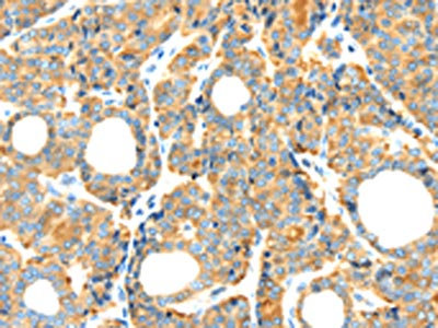 Anti-RIPK4 Antibody