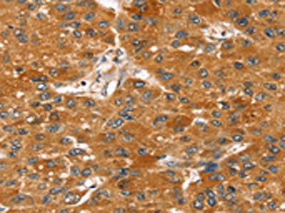 Anti-STARD8 Antibody