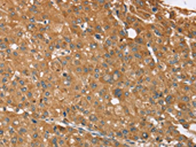 Anti-NOS2 / iNOS Antibody