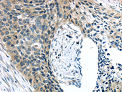 Anti-c-KIT / CD117 Antibody