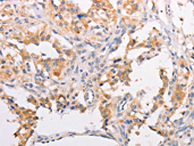 Anti-MYLK3 Antibody