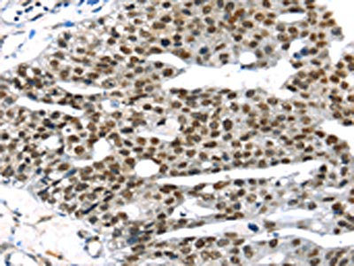 Anti-RRAS Antibody