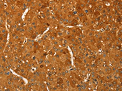 Anti-RPL26L1 Antibody