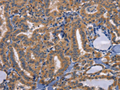Anti-CD47 Antibody