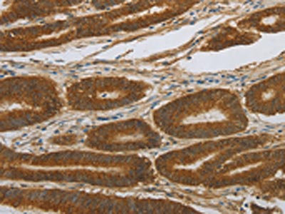 Anti-NOTCH4 Antibody