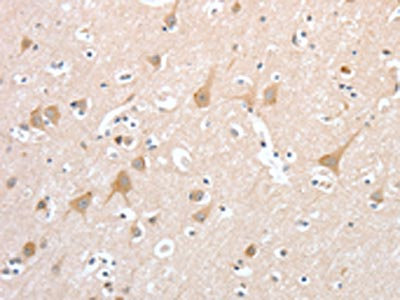 Anti-PCDHB16 Antibody