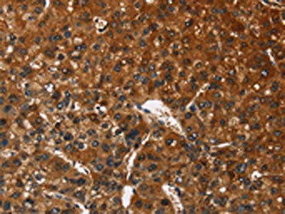 Anti-CATSPER4 Antibody
