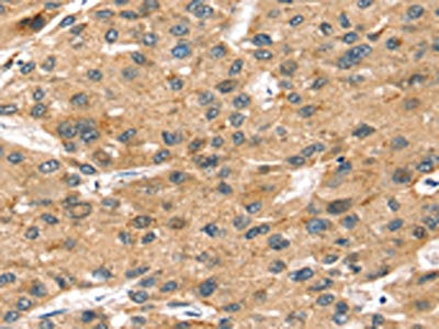 Anti-SORT1 Antibody
