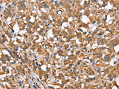 Anti-CSMD1 Antibody