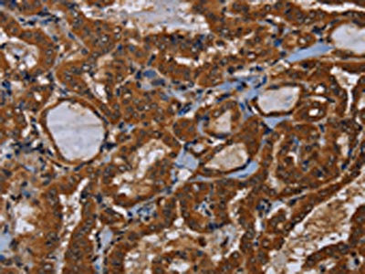Anti-LRRC57 Antibody