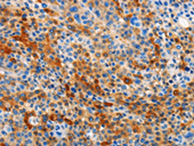 Anti-STAMBP Antibody