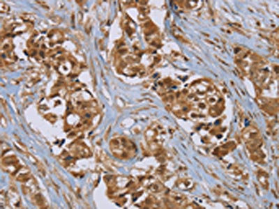 Anti-PUS10 Antibody