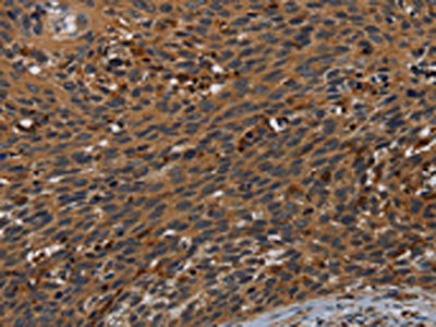 Anti-PCDHB15 Antibody