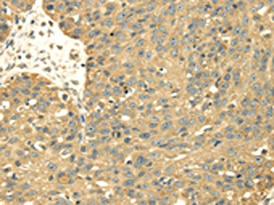 Anti-SRPRB Antibody