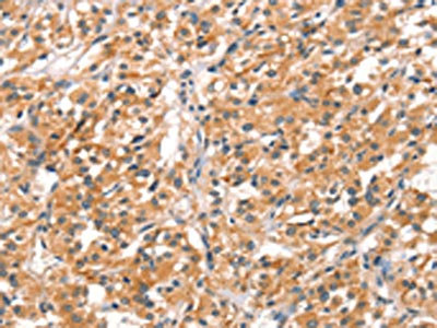 Anti-RHOBTB2 Antibody