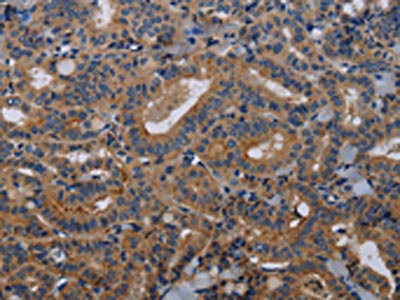 Anti-PVRL3 Antibody