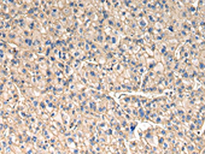 Anti-SLC1A1 Antibody