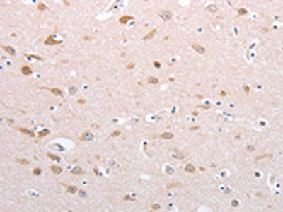Anti-PFN4 Antibody