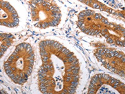 Anti-SLC12A6 Antibody