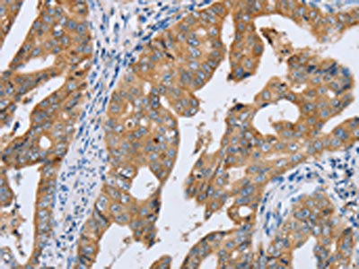 Anti-PTGER2 Antibody