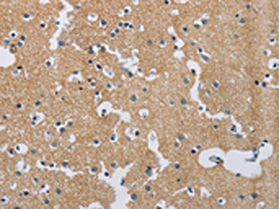Anti-SYN2 / Synapsin-2 Antibody