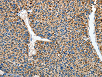 Anti-RCAN1 Antibody