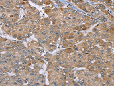 Anti-ACTN2 / Alpha actinin 2 Antibody