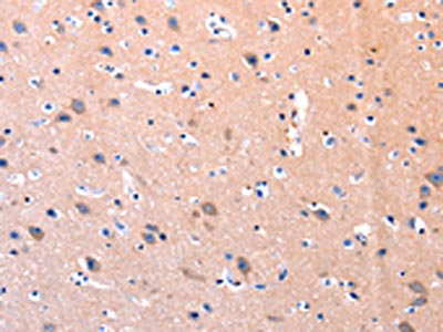 Anti-PTK2 Antibody