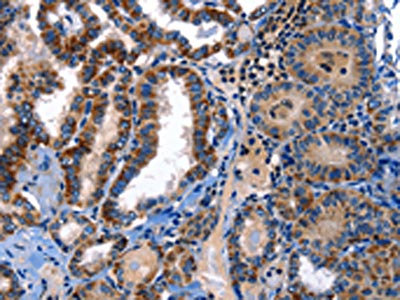 Anti-STAT5A Antibody