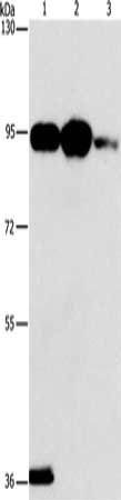 Anti-PLA2G4B Antibody
