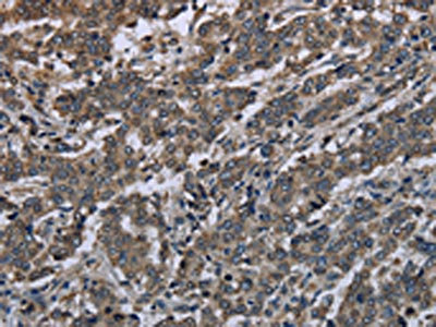 Anti-MAPKAPK2 Antibody
