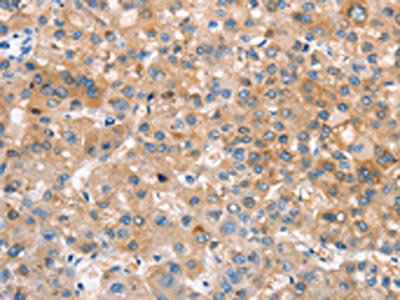 Anti-CRHR2 Antibody