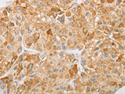 Anti-NGF Antibody