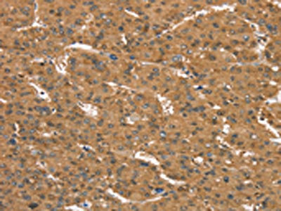 Anti-CD97 Antibody