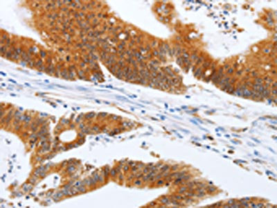 Anti-SPATA13 Antibody