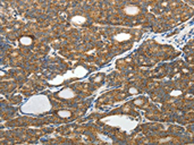 Anti-SLC12A4 Antibody