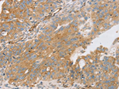 Anti-STX16 / Syntaxin 16 Antibody
