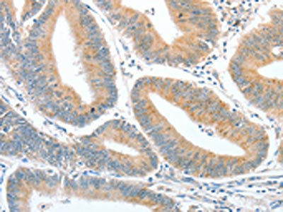 Anti-CKAP2 Antibody
