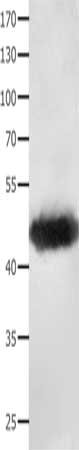 Anti-MAT1A Antibody