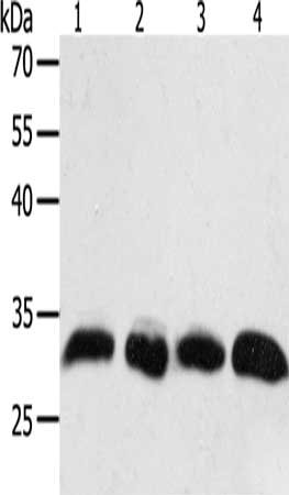 Anti-PTGES2 Antibody