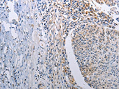 Anti-STAT1 Antibody