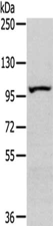 Anti-SENP6 / Sentrin specific protease 6  Antibody