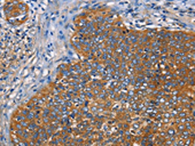 Anti-NT5E Antibody