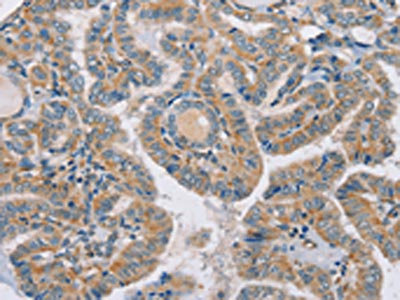 Anti-RAB21 Antibody