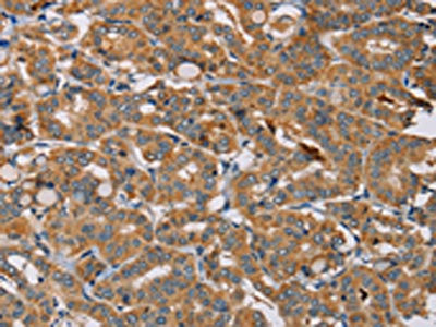 Anti-MBNL3 Antibody