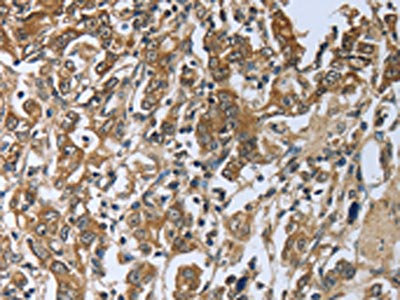 Anti-PRL / Prolactin Antibody