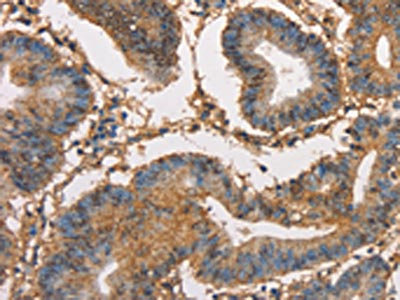 Anti-HK3 / Hexokinase 3 Antibody